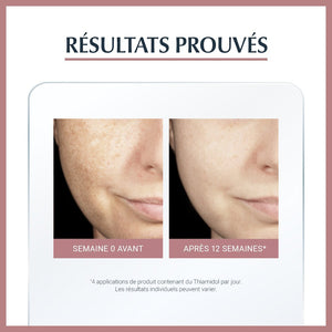 Eucerin ANTI-PIGMENT SÉRUM DUO 30 ML + Ecran pigment spf50 OFFERT