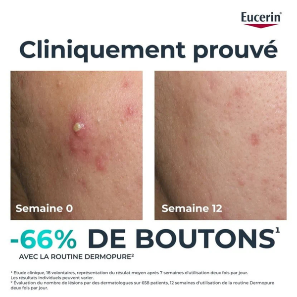 EUCERIN DERMOPURE TRIPLE ACTION SERUM