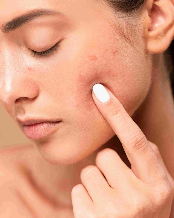 MDC EXCELLENCE HYALURONIC ACID SERUM - Ma boutique