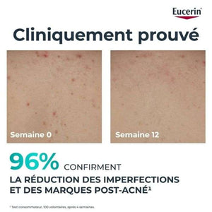 EUCERIN DERMOPURE CREME CORPS TRIPLE ACTION 200 ML