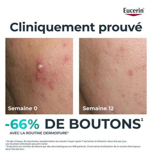 EUCERIN OFFRE DERMOPURE SERUM TRIPLE ACTION 40 ML + EUCERIN OIL CONTROL SPF 50+ 50 ML OFFERT