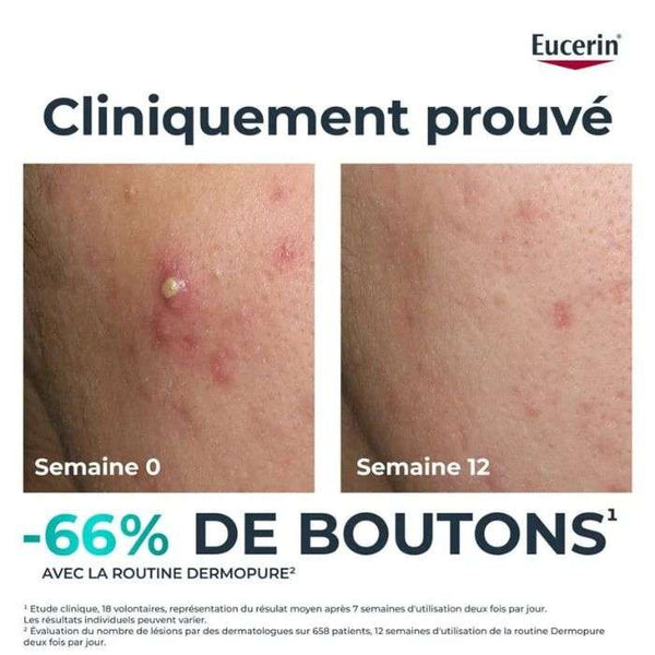 EUCERIN OFFRE DERMOPURE SERUM TRIPLE ACTION 40 ML + EUCERIN OIL CONTROL SPF 50+ 50 ML OFFERT